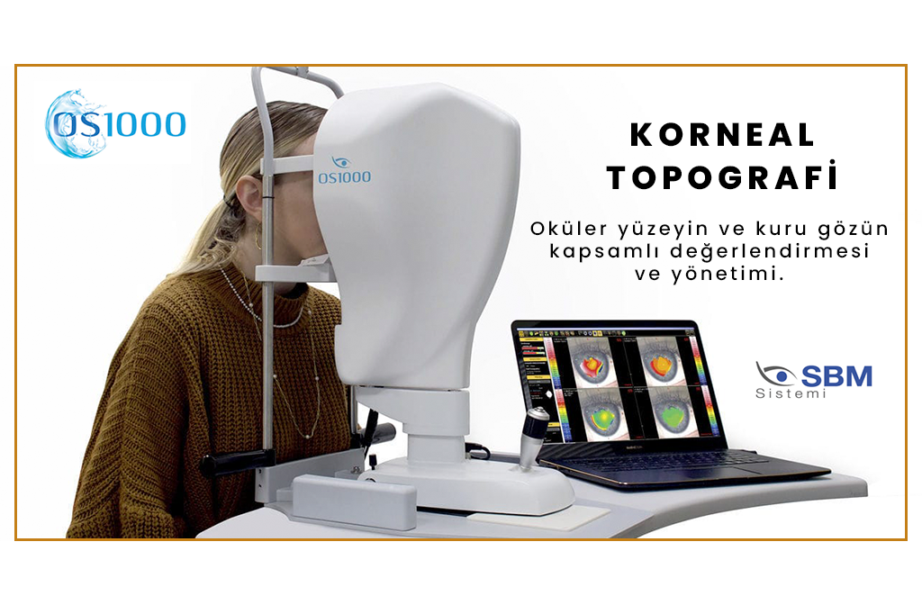 SBM Sistemi – OS1000